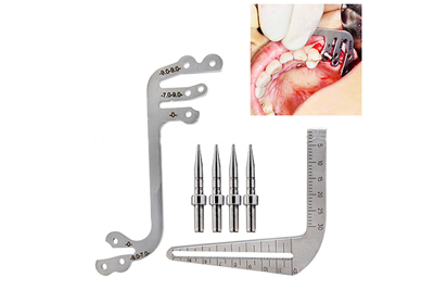 Dental Implant Locating Guide - DILG